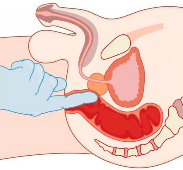 G-point stimulation in men through the anus