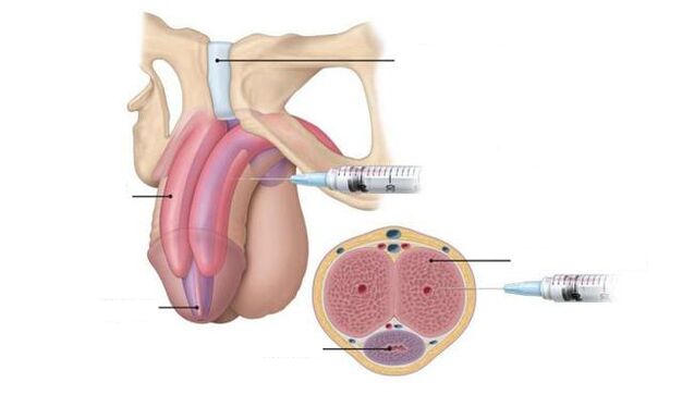 injections to increase potency